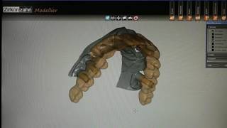 Zirkonzahn system implant type screw retained full arch Prettau [upl. by Ani732]