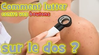 bouton dacné  Comment lutter naturellement contre vos boutons sur le dos [upl. by Darsie906]