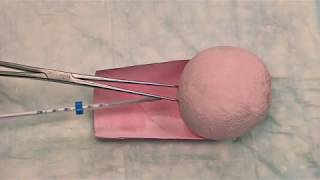 Hormonal IUD LNGIUS Insertion Technique [upl. by Charlena927]