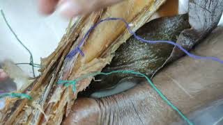 Structures in ANTEROLATERAL COMPARTMENT OF LEG  LOWER LIMB ANATOMY DISSECTION [upl. by Min]