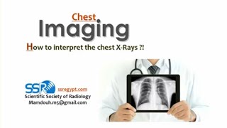 1Chest X ray interpretation  Prof Mamdouh Mahfouz [upl. by Mitzi235]