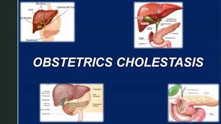 Obstetric Cholestasis RCOG Guideline [upl. by Ecnarret413]