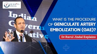 What is the Procedure of Geniculate Artery Embolization GAE  Dr Ravul Jindal Explains [upl. by Ahsinroc697]