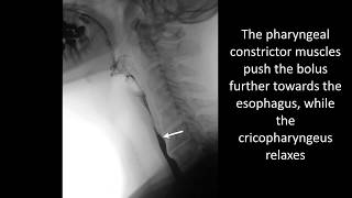 Swallowing disorders  Normal swallowing [upl. by Gimpel]