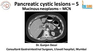 Mucinous cystic neoplasm of pancreas  Pancreatic cystic neoplasms part 5  Edusurg Clinics [upl. by Tertia]