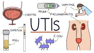 ✅ Fungal Infection क्या और कैसे होता है ✅ Fungal Infection Symptoms Causes and Treatment in Hindi [upl. by Noryt375]