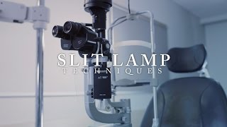 Ophthalmology Slit Lamp Techniques ubcmedicine [upl. by Malena]