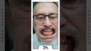 ✨ quotRadiant Smiles in Istanbul Turkey  Dental Transformation  DMAX Healthquot [upl. by Ari359]