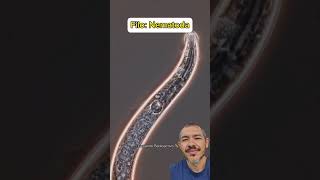 Verme Magnífico e Brilhante Filo Nematoda biologia animais microscopio curiosidades zoom [upl. by Adlih]