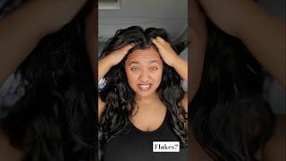 STRUGGLING WITH AN ITCHY SCALP FLAKES PRODUCT BUILD UP TRY THIS [upl. by Aidyl]