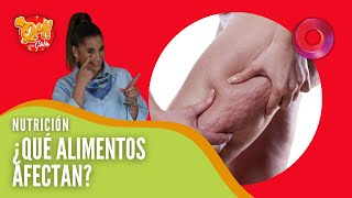 Cómo Eliminar la Retención de Líquidos en el Cuerpo [upl. by Hadeehsar]