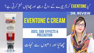 Eventone c cream  How To Use Side Effects In Detail  Dr Review [upl. by Lohse]