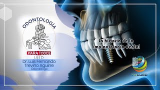 Odontología para todos quotLa historia de la implantología dentalquot [upl. by Nnel]