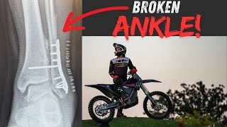 I Broke My Ankle Without Crashing [upl. by Eboh422]