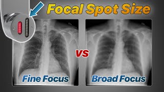 Focal Spot Size Explained Fine vs Broad Focus [upl. by Finer]