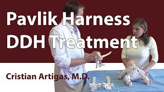 Pavlik Harness DDH Treatment [upl. by Ayotak]