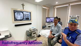 Radiofrequency Ablation Lumbar [upl. by Ellienad712]