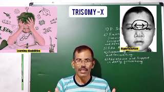 TRISOMYX OR TRIPLE X SYNDROME  SAM BIOLOGY 🧫 CLASS [upl. by Otipaga943]