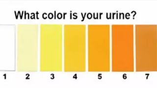 Your Urine Color Reveals Health Problems  The color of your urine says a lot about your health [upl. by Monafo383]