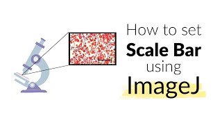 How to set Scale Bar using ImageJ software  Microscope  Imaging howto image [upl. by Koser]