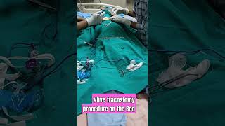 live tracostomy procedure on the Bedshort [upl. by Aerdnat981]