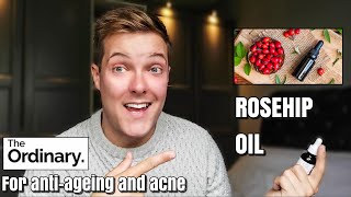 ROSEHIP OIL  30 day test on oily skin  The Ordinary rosehip oil  rosehip oil before and after [upl. by Ahtabbat]