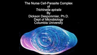 Nurse cellparasite complex of Trichinella [upl. by Godfrey]