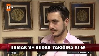 Damak ve dudak yarığına son  atv Ana Haber [upl. by Varin]