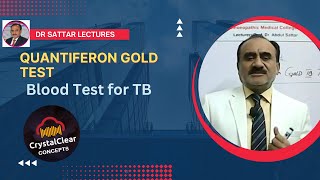 Quantiferon Gold TB Test  A Blood Serum test for TB Diagnosis [upl. by Millar]