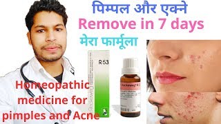 R53 homeopathic medicine for acne pimples [upl. by Small]