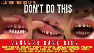 The Dark Side of Veneers Pain Scams and Regret  JEJE VIBE EP 75 [upl. by Yeslah]