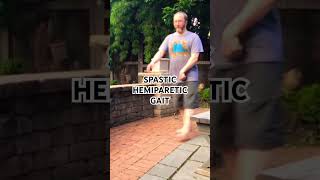 SPASTIC Hemiparetic Gait [upl. by Meehahs]