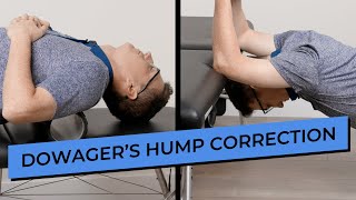 5 Effective Exercises to Fix Neck Hump Dowagers Hump [upl. by Anirtak]