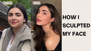 face transformation without surgery my journey controlling pcos amp cortisol [upl. by Grace285]