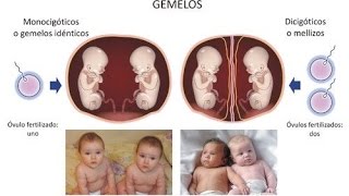 Las 4 señales TEMPRANAS de que estás embarazada de GEMELOS [upl. by Tahpos91]