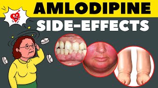 Amlodipine Side Effects amp How to Avoid  Amlodipine Adverse Effects [upl. by Odareg]