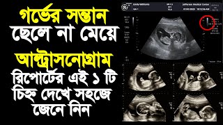 আল্ট্রাসনোগ্রাম রিপোর্ট দেখে কিভাবে বুঝবেন গর্ভের বাচ্চা ছেলে না মেয়ে ultrasound report pregnancy [upl. by Toshiko792]