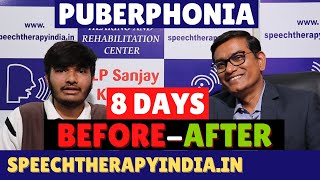 BeforeAfter Puberphonia Speech Therapy  Within 8 Days  slpsanjaykumar  Speech Pathologist India [upl. by Gardel189]