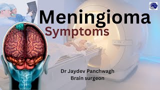 Meningioma The Brain Tumor You Might Have And Not Even Know It [upl. by Ocer]