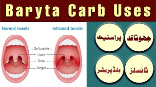 Baryta Carb Homeopathic Medicine Uses  Baryta Carb 200 health homeopathy doctor [upl. by Frerichs]