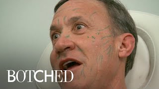 Dr Terry Dubrow Freaks Out Paul With Face Filler Treatment  Botched  E [upl. by Dwyer]