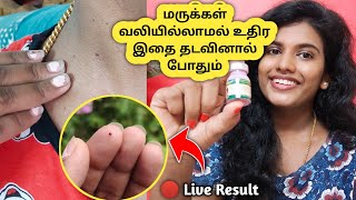 ♦️₹ 80 செலவில் மருக்கள் உதிரும்💯How to remove warts ➡️ Remove skin warts  home 🔥 Effective remedy 😱 [upl. by Spurgeon]