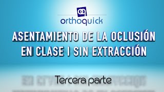 ASENTAMIENTO DE LA OCLUSIÓN EN CALSE I SIN EXTRACCIÓN TERCERA PARTE [upl. by Aynas]