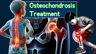 Understanding Osteochondrosis Symptoms causes and treatment [upl. by Toddie753]