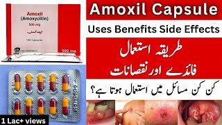 Amoxil Capsule Uses In Urdu  Amoxil Capsule 500mg  Amoxil Capsule 250 mg [upl. by Culver]