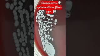 Staphylococcus epidermidis Colony Morphology on Blood Agar [upl. by Squire]