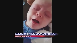 Whooping cough video goes viral [upl. by Nnave]