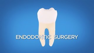 surgical endodontics apicoectomy [upl. by Notnroht]