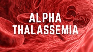 Alpha Thalassemia  Symptoms diagnosis and pathology [upl. by Hctub629]