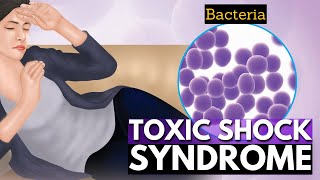 Toxic Shock Syndrome A Closer Look at the Rare but Serious Condition [upl. by Dominy]